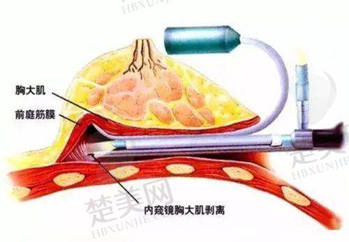三、上海某医院（资料未明确第三家名称）——眼鼻综合与微整的好选择