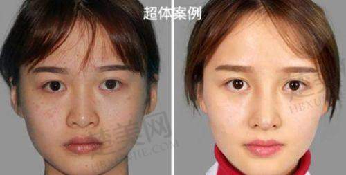 一、上海时光整形外科医院怎么样？正规靠谱
