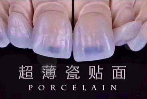 是否值得前往