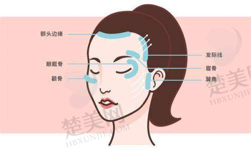 广州地区割双眼皮手术实例