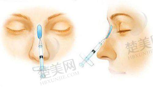 二、贵阳利美康整形外科医院怎么样？
