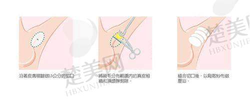 四、广州美莱医疗美容整形医院