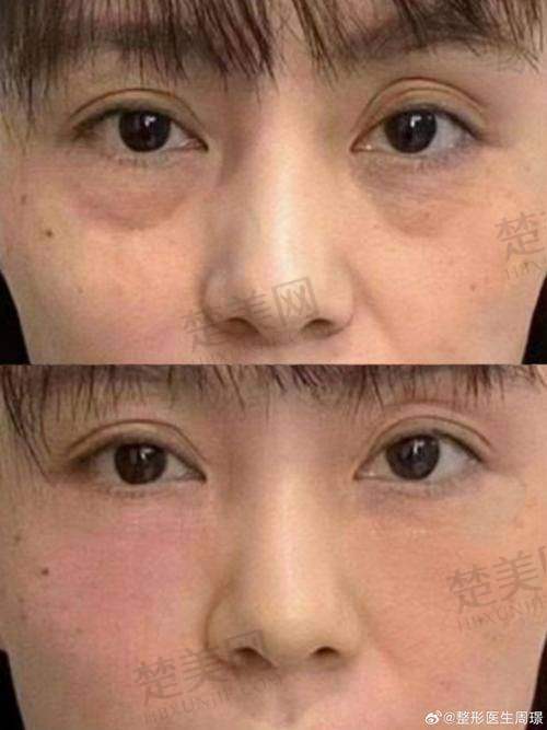 五、安心性与术后护理