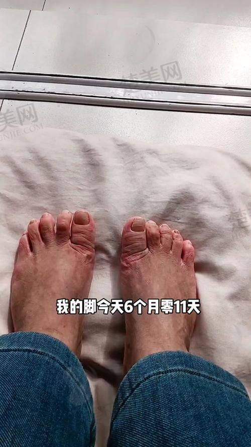 六、北京做大脚骨医生苏敬达之口碑评价