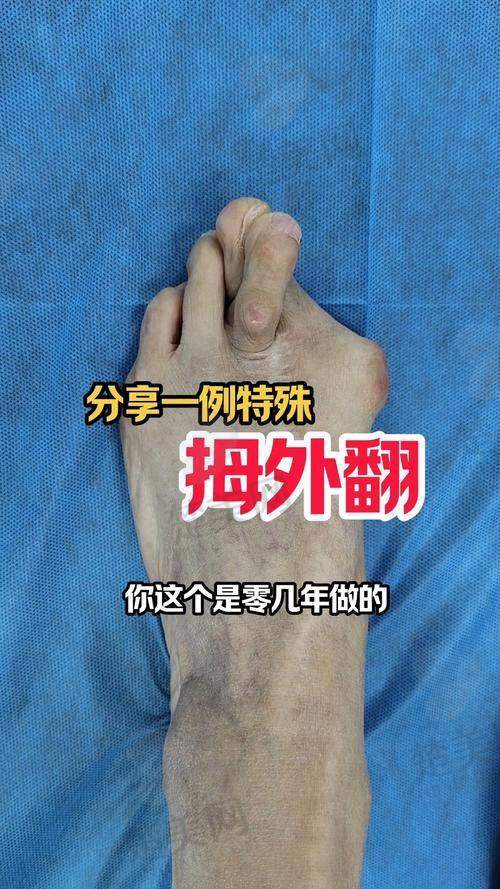 一、北京做大脚骨医生苏敬达之个人简介