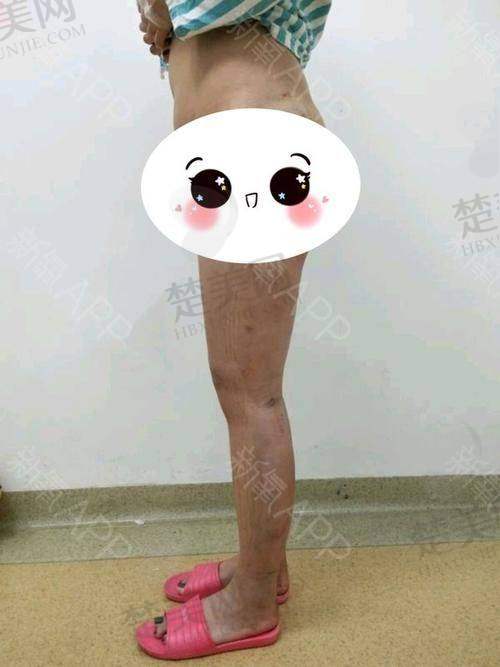 二、北京大小腿吸脂医生排名前十之“二梯队：性价比特别高”