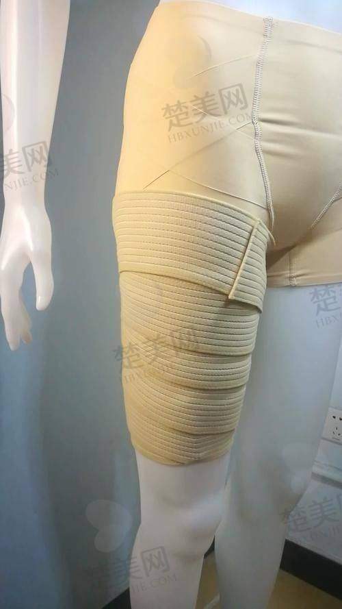 一、北京大小腿吸脂医生排名前十之“一梯队：吸脂界精品大佬”