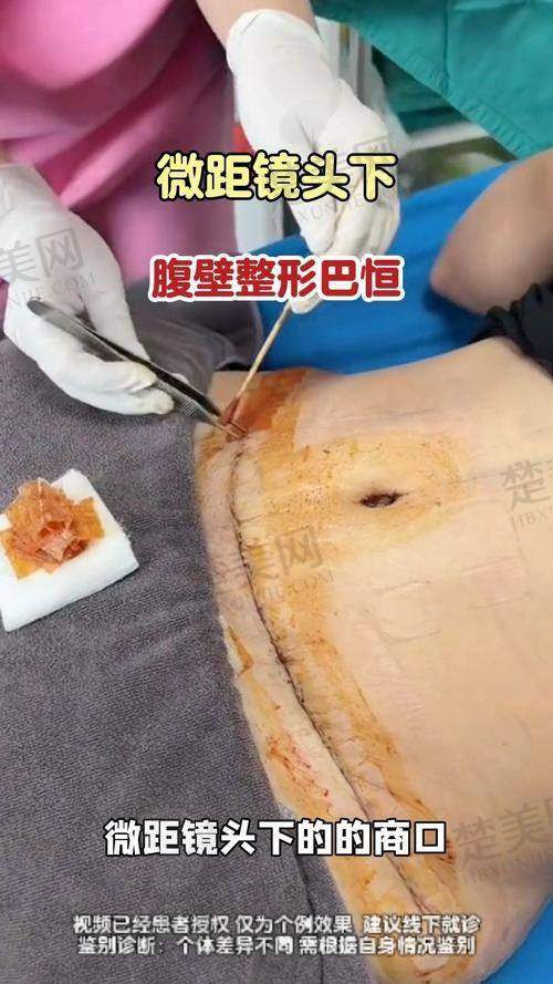 五、杭州美莱医疗美容医院
