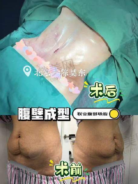三、杭州整形医院
