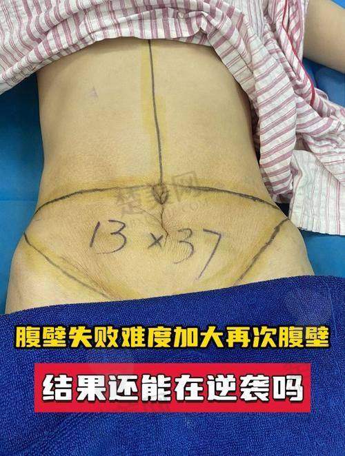 一、浙江大学医学校附属第二医院整形科