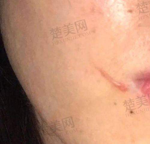 五、常州奥玛星光医疗美容——齐全服务助力疤痕修复