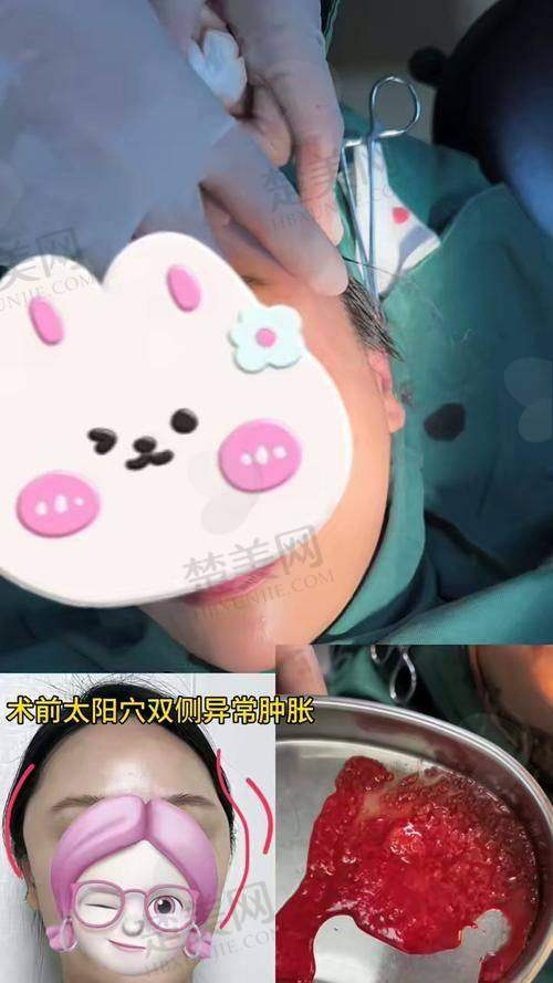 四、广州海峡——谭新东医生