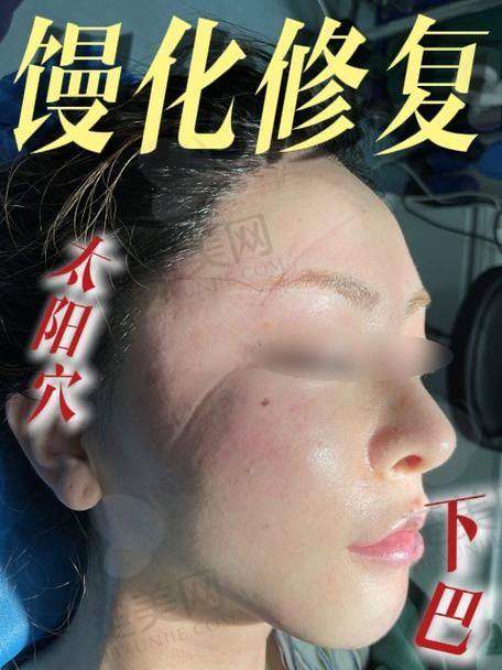三、广州中家医家庭医生——黄广香医生
