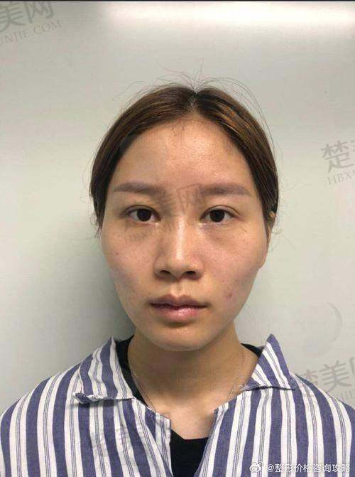 五、患者真实反馈