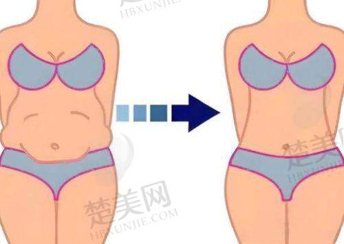 五、价格与性价比
