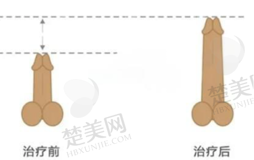 四、济南俏嘉丽医疗美容医院特色项目
