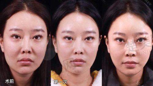 四、保定珍润医疗美容门诊部:眼部与鼻部整形的特色之选