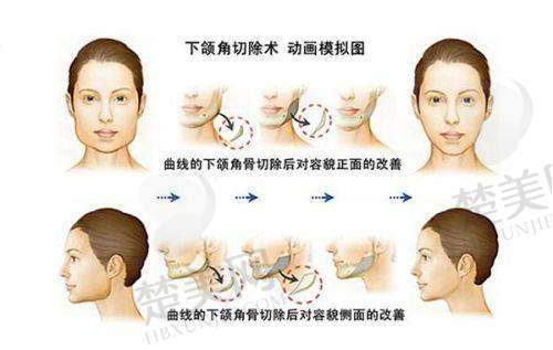 一、温州云谣医疗美容门诊部正规吗?