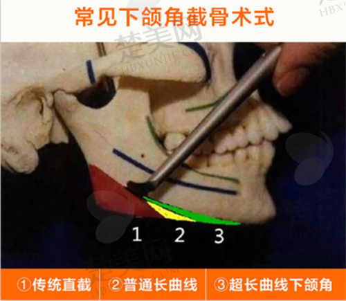 三、拉萨维多利亚整形美容医院诊疗项目有哪些？