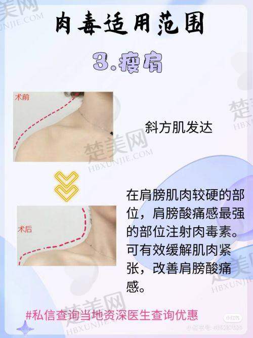 四、武汉瑞美淇医疗美容门诊部特色项目