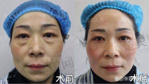 六、深圳贝漾美天曹思佳——近2万花费物超所值