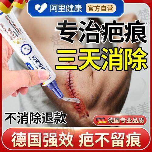 三、成都疤研疤痕医院怎么样？
