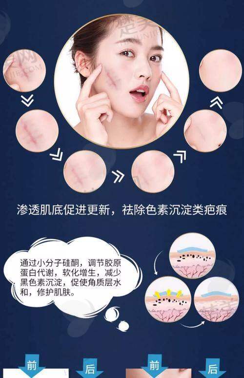 二、成都疤研疤痕医院靠谱吗？