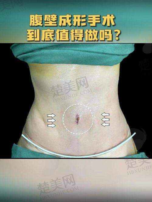 总结