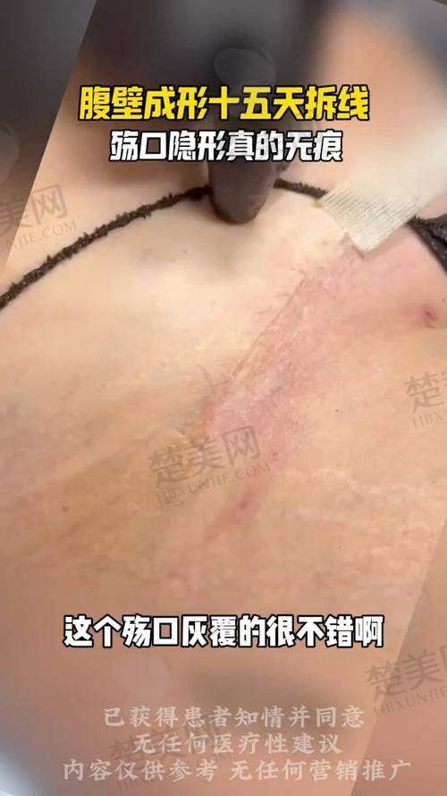 七、总结