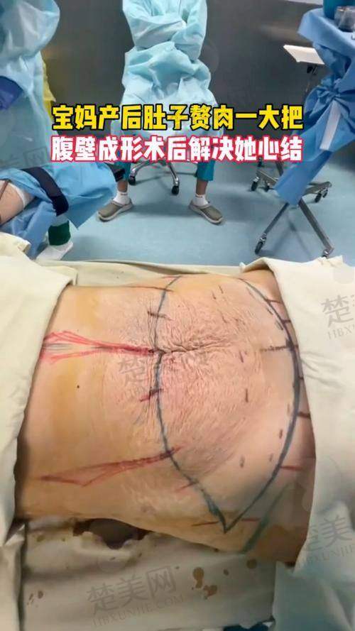 三、选择医生的注意事项
