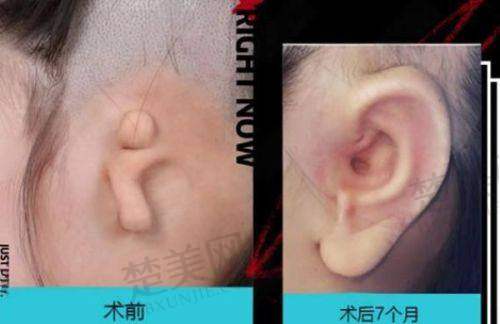 八、徐州京城皮肤病医院医疗美容科真实的患者评价
