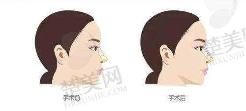 三、李保锴医生的出诊时间是啥时候?