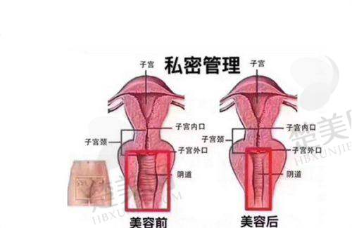 六、张成聪医生——眼部重塑的高能医师