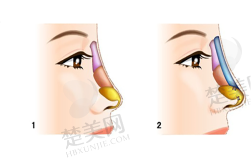 三、深圳鹏程医院是国有还是私立？私立医院也有大优势