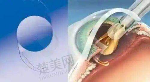 四、深圳鹏程医院口碑怎么样？好评如潮