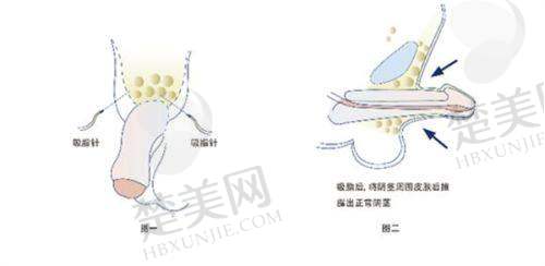 七、长葛鑫鸿基医院整形科地址及交通