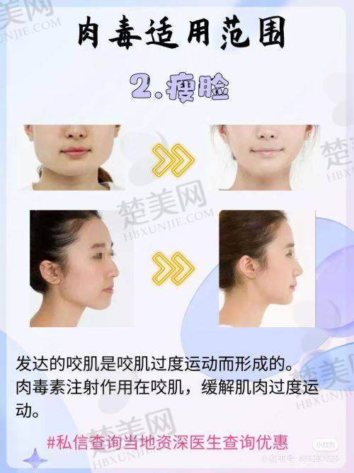 五、广州海峡整形医院的口碑医美全分享