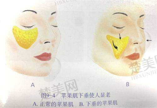 三、长葛鑫鸿基医院整形科诊疗项目有哪些？
