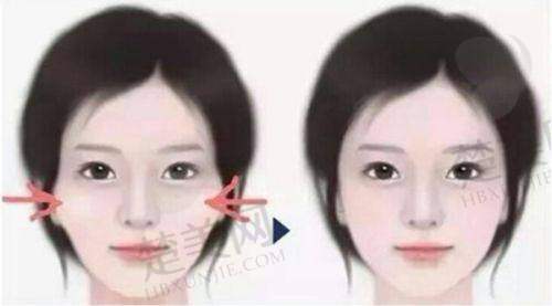 五、徐州京城皮肤病医院医疗美容科价格表