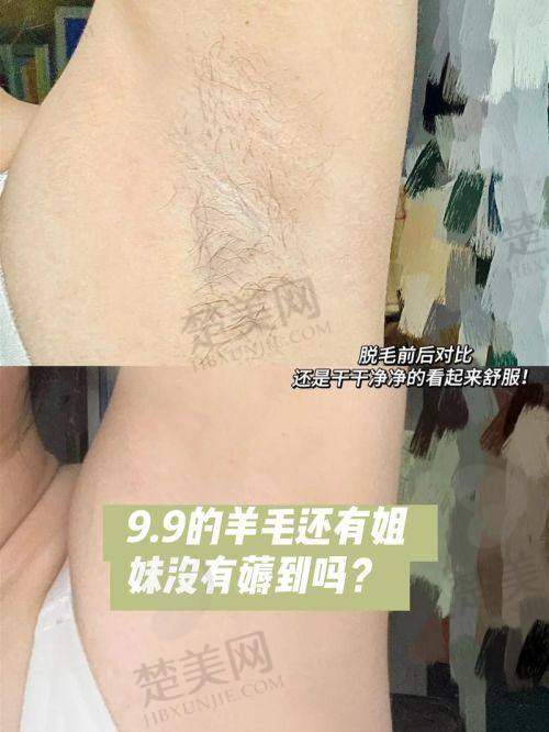 二、大连达美元辰医疗美容医院：老牌医美机构的脱毛实力