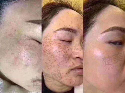 三、佳木斯美白医疗美容