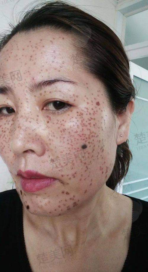 五、佳木斯大学附属第一医院整形科