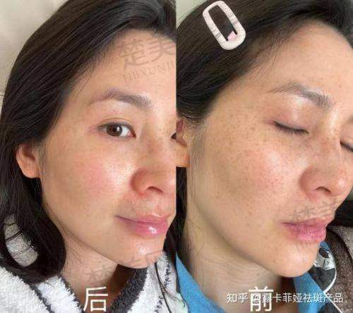 一、佳木斯韩艺来医疗美容医院