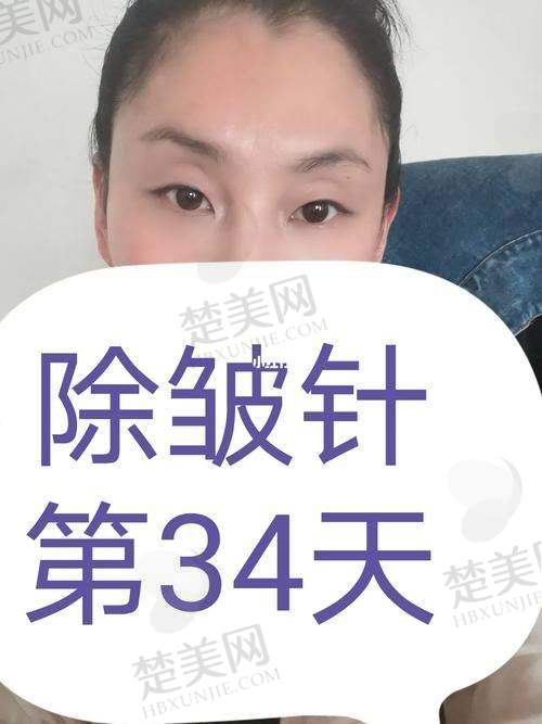六、赵江辉医生——广州美莱整形美容医院