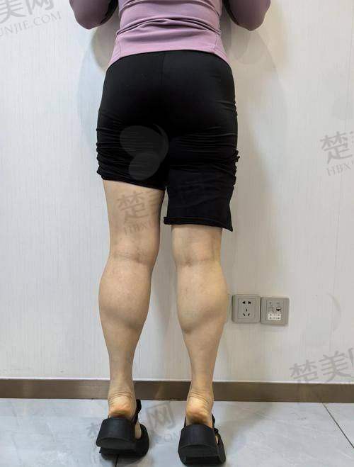 三、漯河市第二人民医院皮肤科——特色专科的别样选择