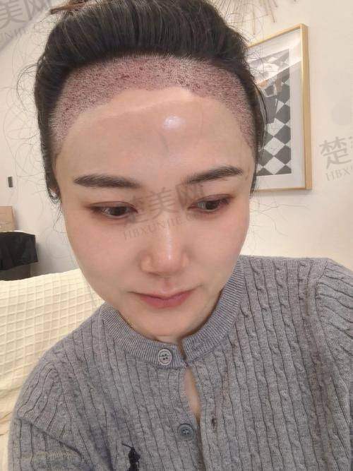 十、厦门美莱医疗美容医院植发中 心——连锁品牌的亲民植发科室