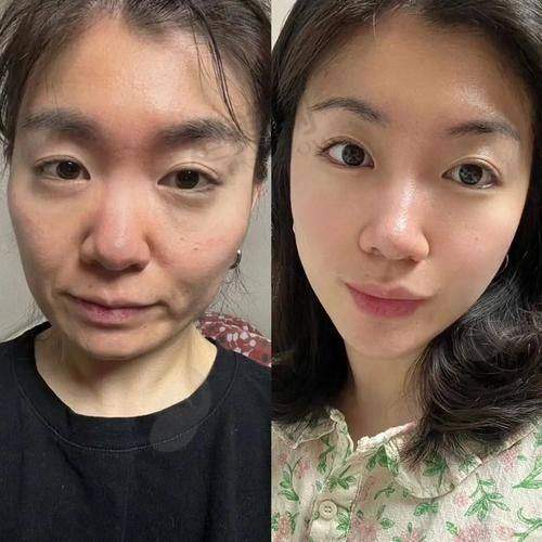 三、北京黄寺整形美容医院的王牌医生都有谁？