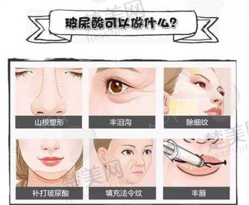 二、南京医科大学友谊整形外科医院宿迁医疗美容门诊部怎么样？