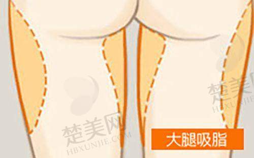 四、南阳市第三医院美容科成功实例
