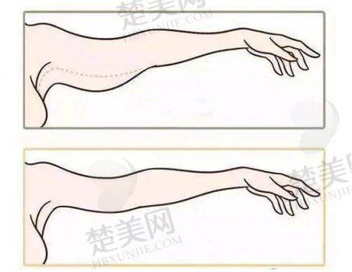 八、成都青羊丝缘植发医疗美容门诊部真实的患者评价